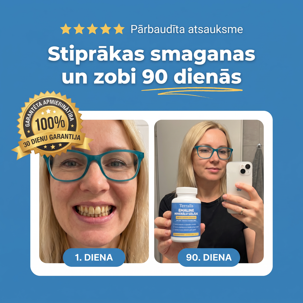 Rezultāts pirms un pēc Emaline lietošanas