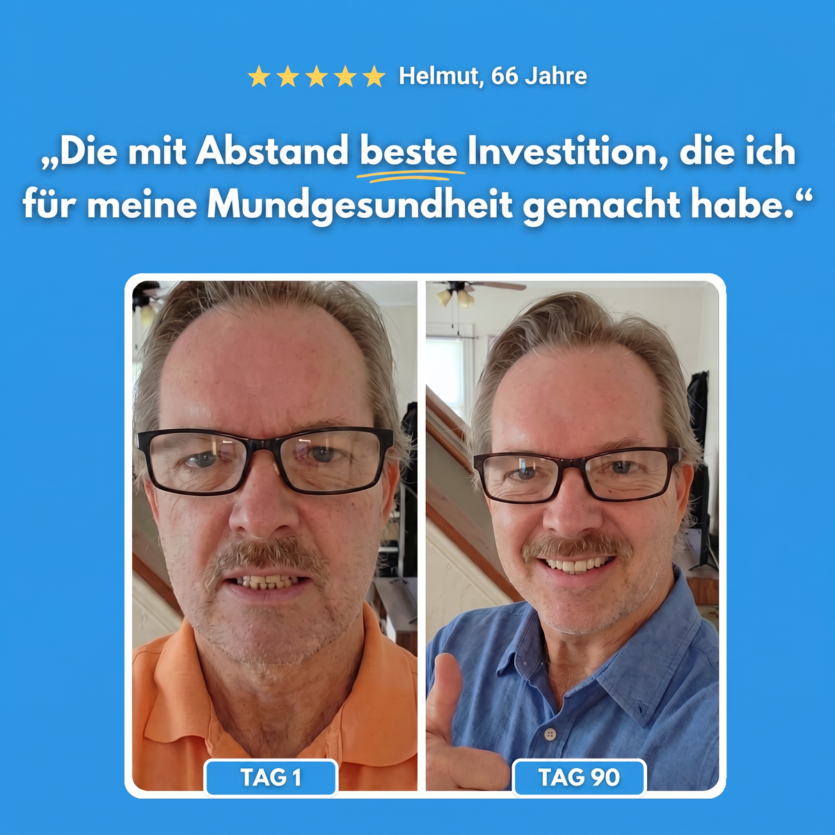 Erfahrungsbericht vorher und nachher einer Emaline Anwenderin