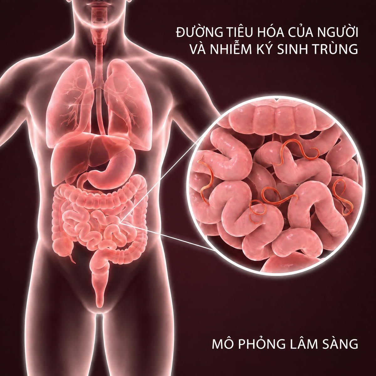 Bộ thải độc đường ruột 2 bước Evicta - 1190EVC-VN